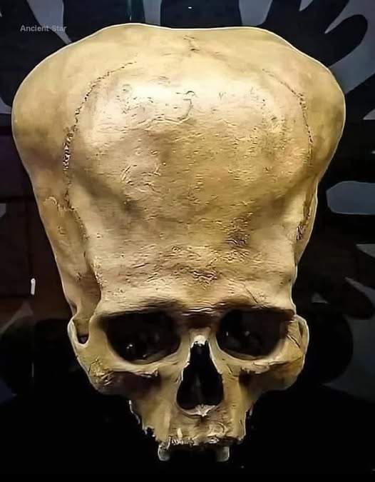 The Mystery of the Paracas Skulls: Ancient Secrets from the Peruvian Desert