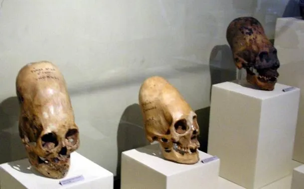 Paracas elongated skulls