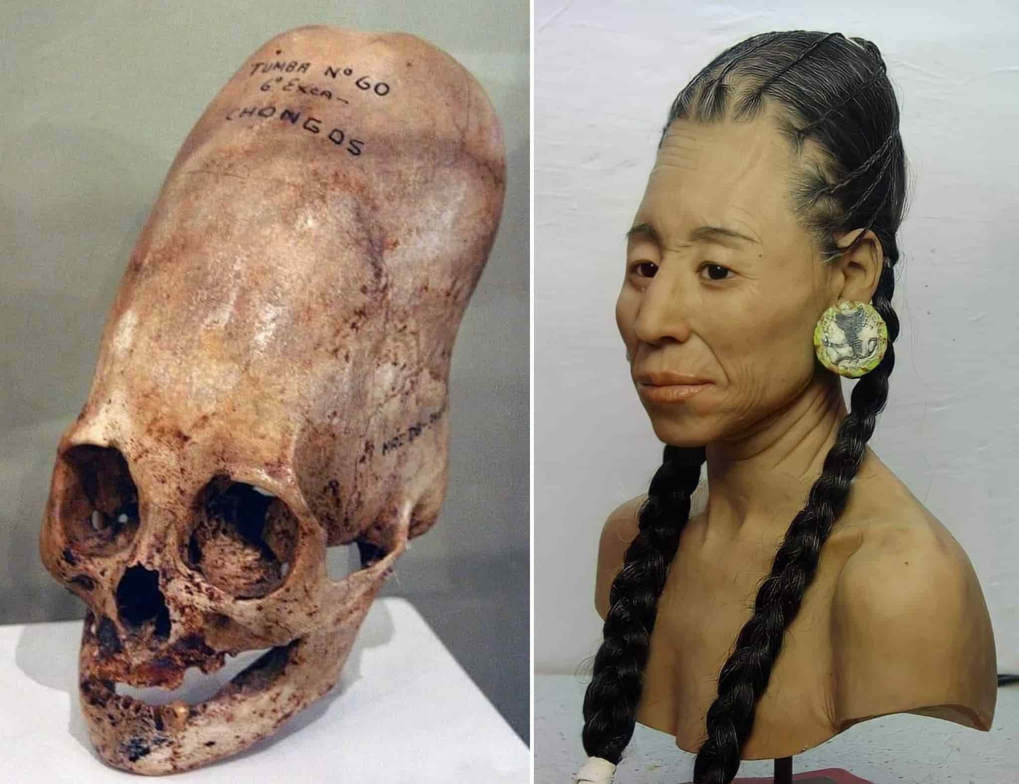Paracas elongated skulls