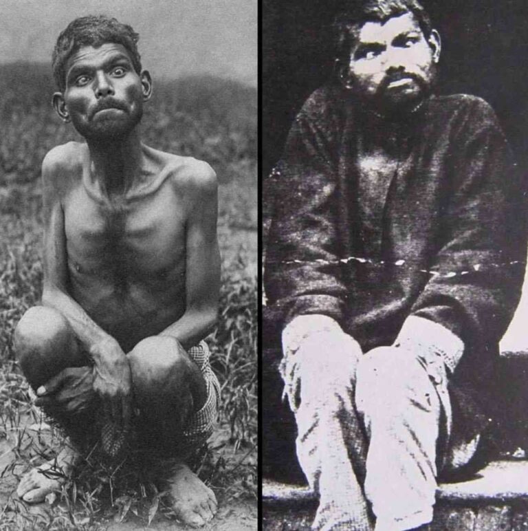 The Real-Life Mowgli – Dina Sanichar