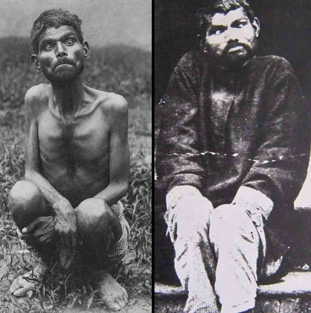 The Real-Life Mowgli – Dina Sanichar